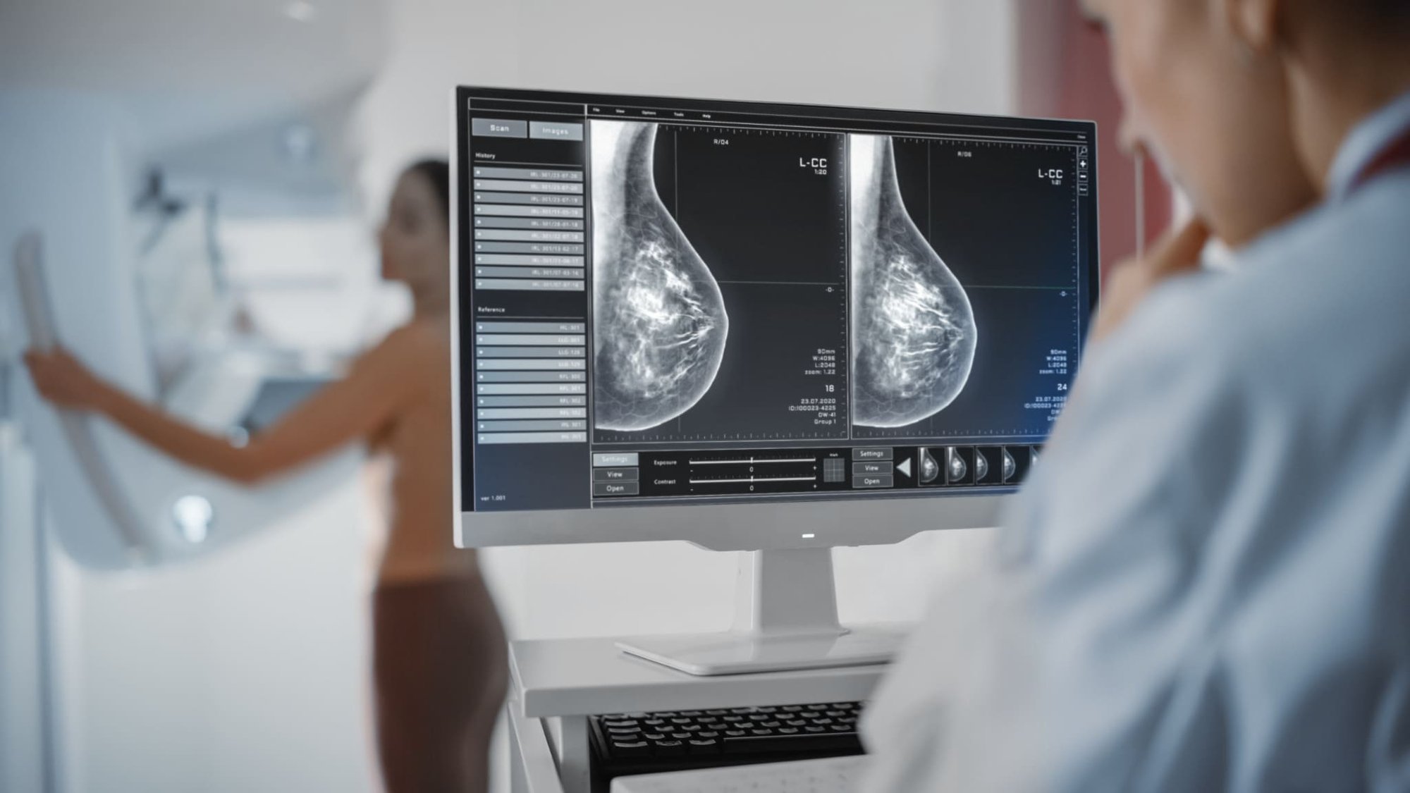 Patientin erhält eine Mammographie. Ärztin steht am Bildschirm und schaut sich die Bilder an